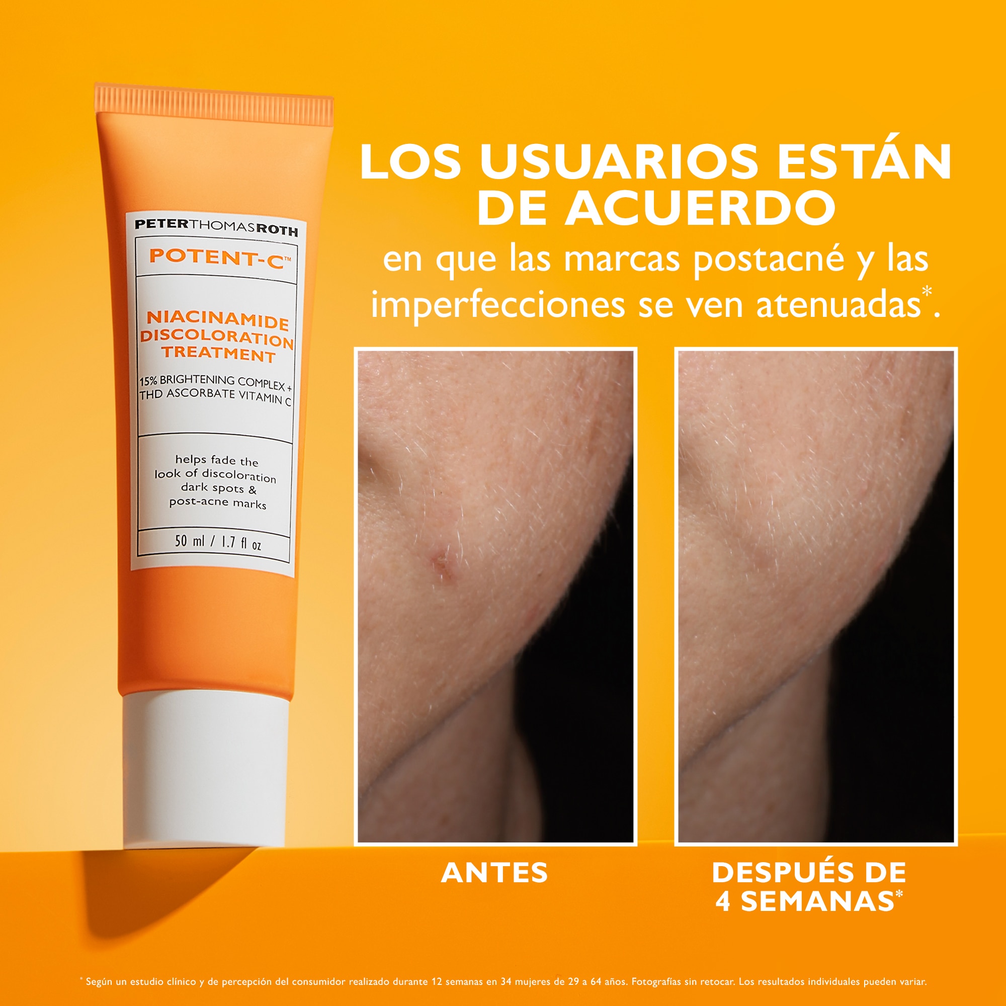 POTENT-C™ NIACINAMIDE DISCOLORATION TREATMENT (GEL-CREMA.FACIAL)
